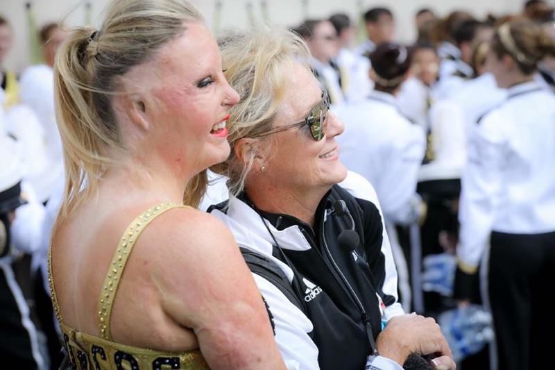 Bolinger and Keiser, 2018